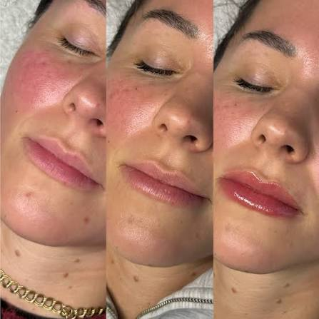 Three-stage lip blush progression from healed to freshly glossed lips