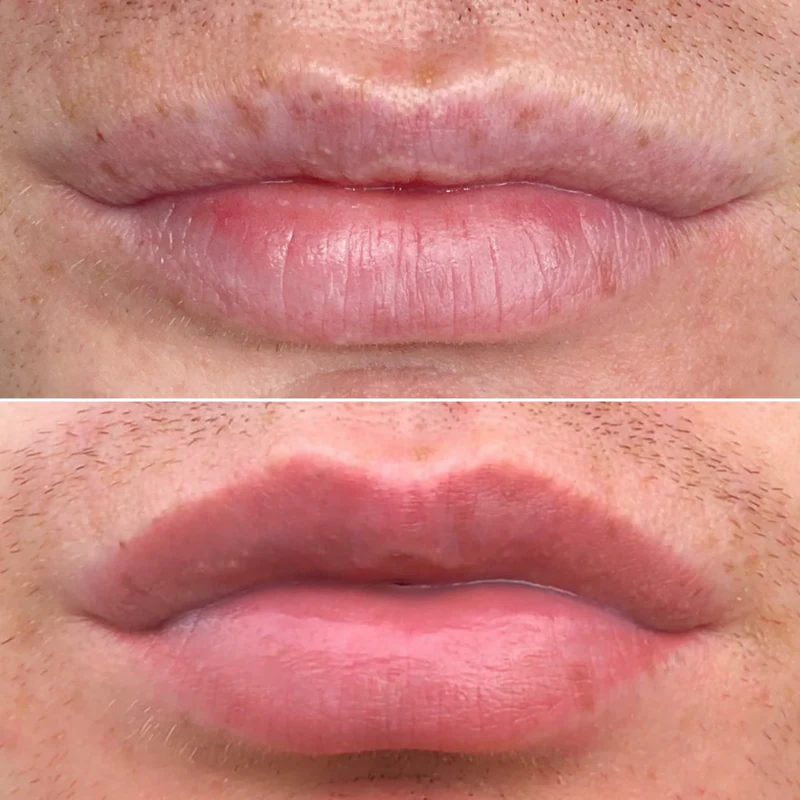 Before and after full lip blush transformation