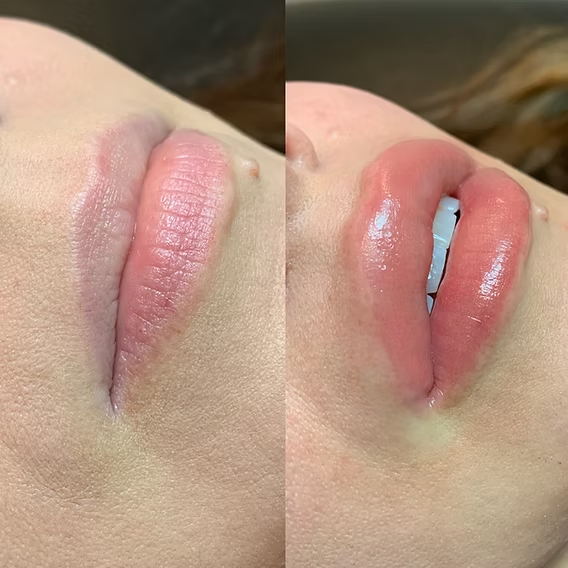 Before and after glossy lip blush result