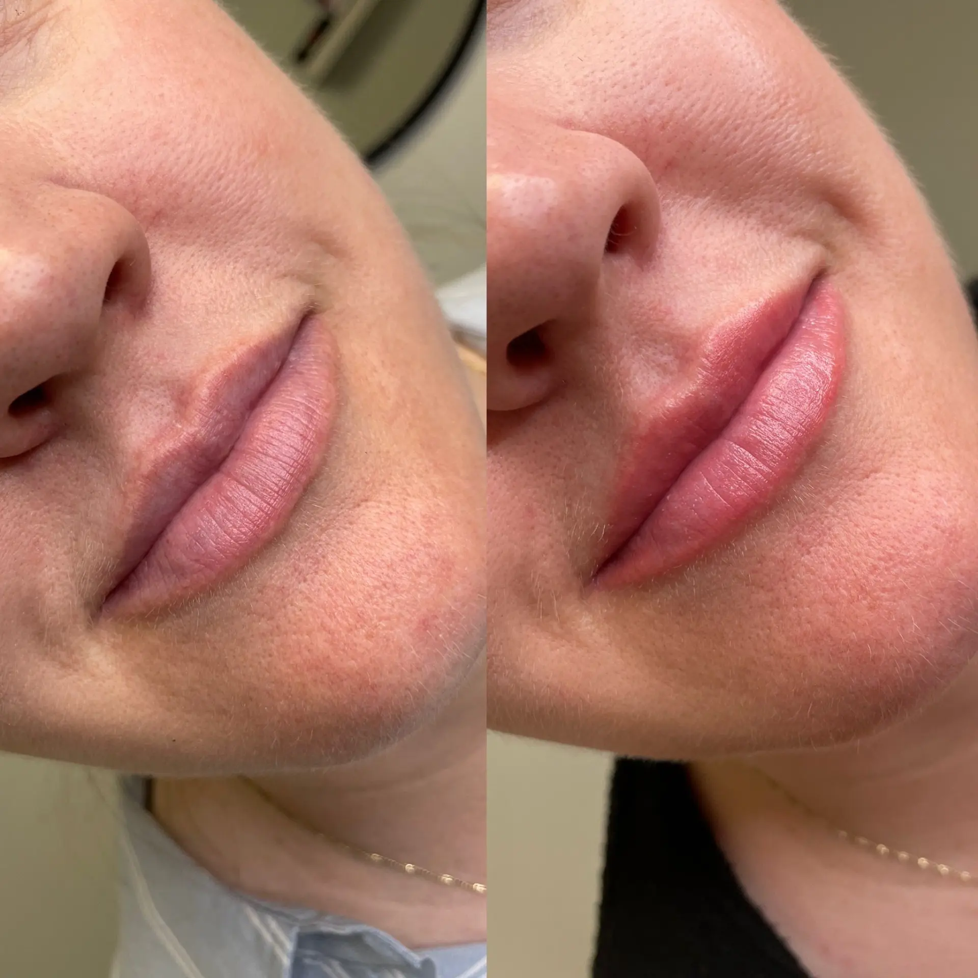 Before and after lip blush on a mature client