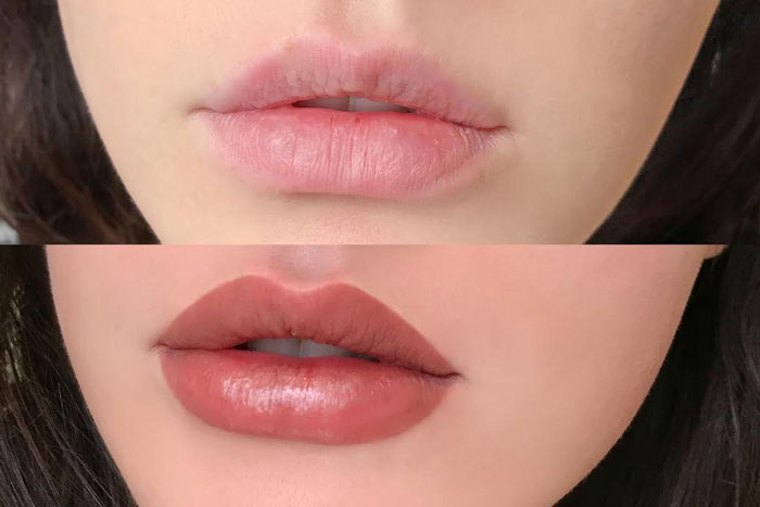Before and after of a natural lip blush treatment