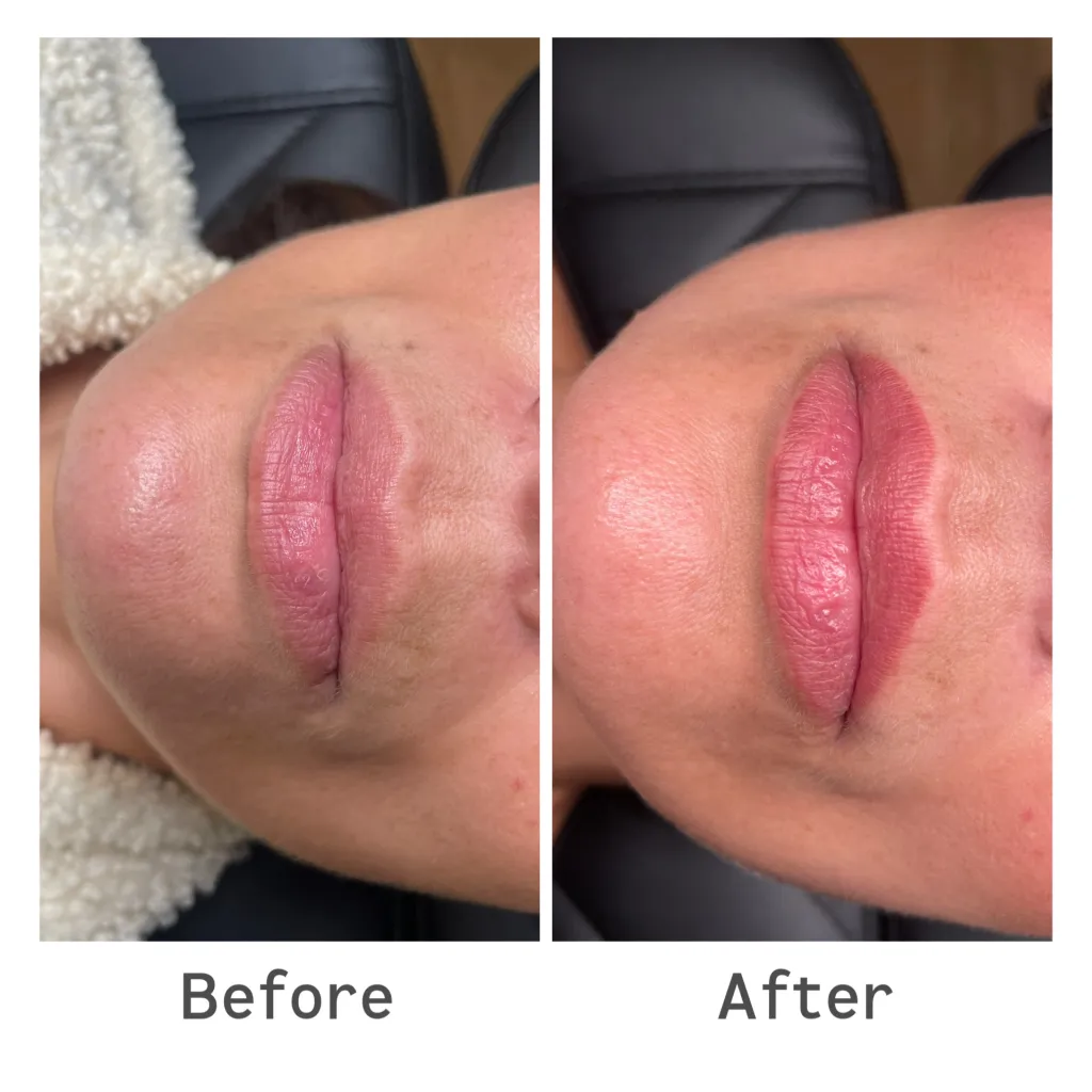Before and after lip blush treatment